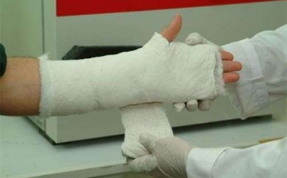 Hand and Finger Fracture Reparations 